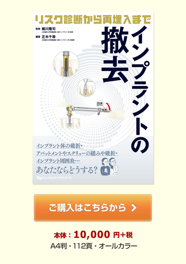 インプラントの撤去 ～リスク診断から再埋入まで～