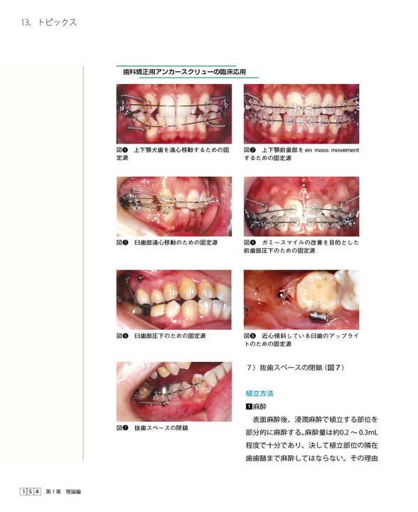 矯正臨床 一般歯科医のための理論と実務