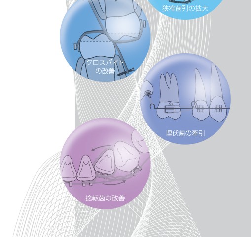 部分矯正 その臨床応用のすべて